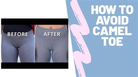 how to get rid of camel toe|How To Prevent Camel Toe, No Matter What Youre。